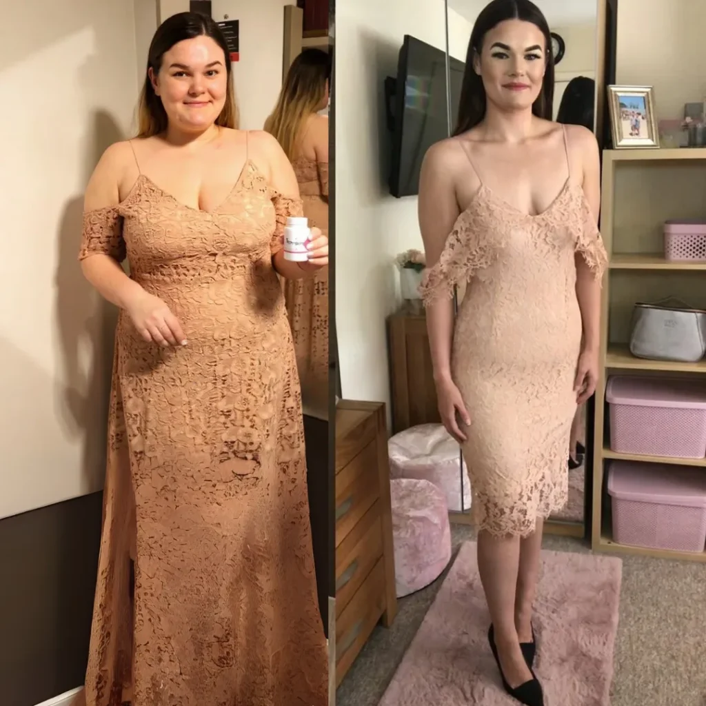 Antes e depois de mulher usando Monjarim — resultado real de emagrecimento